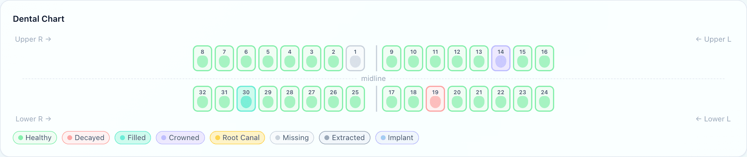 Dental chart showing all 32 teeth in Universal numbering across upper and lower arches, with tooth 30 marked filled, 19 decayed, 14 crowned and 1 missing, and a legend of tooth states